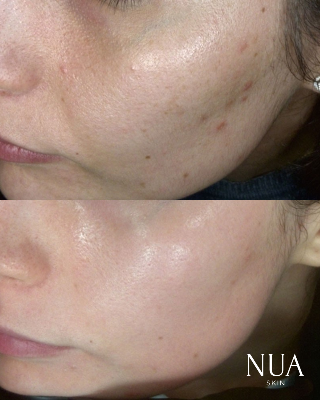 Before and after pigmentation treatment — Clarity Restored